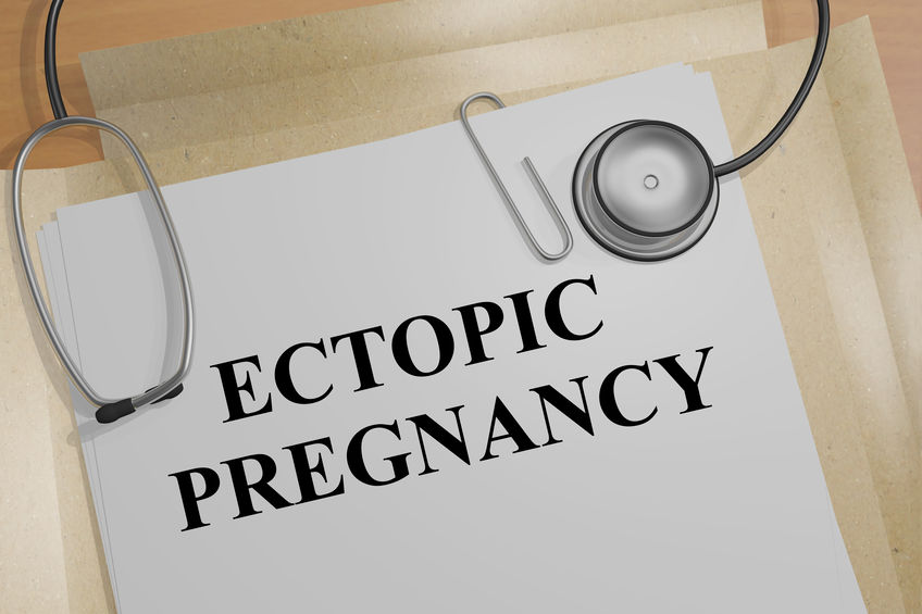 medico-legal ectopic pregnancy