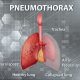 pneumothorax in the ed