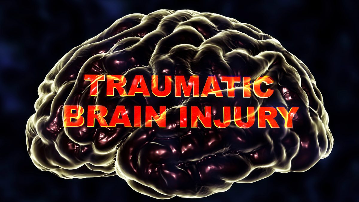 nice guidelines head injury