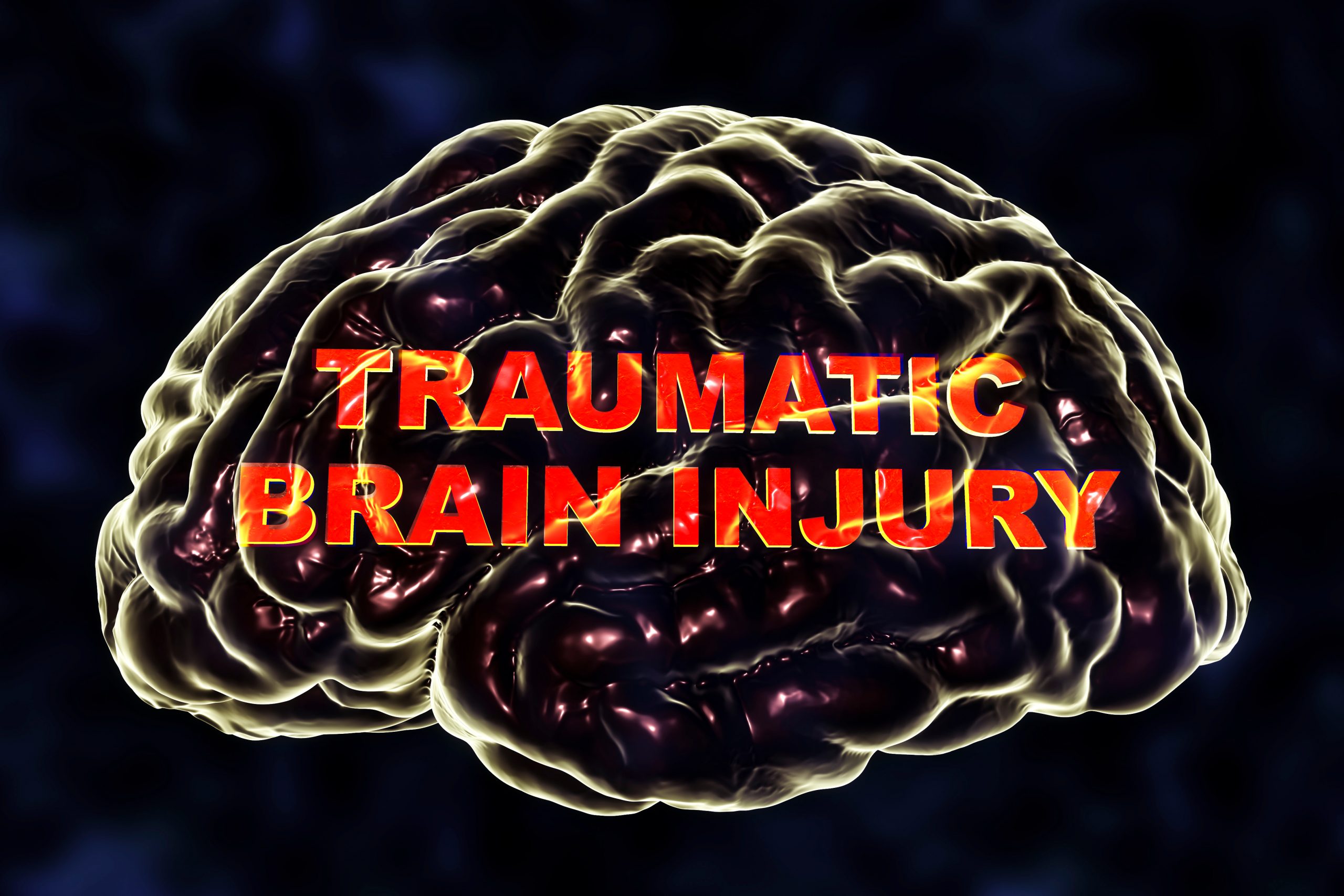 nice guidelines head injury