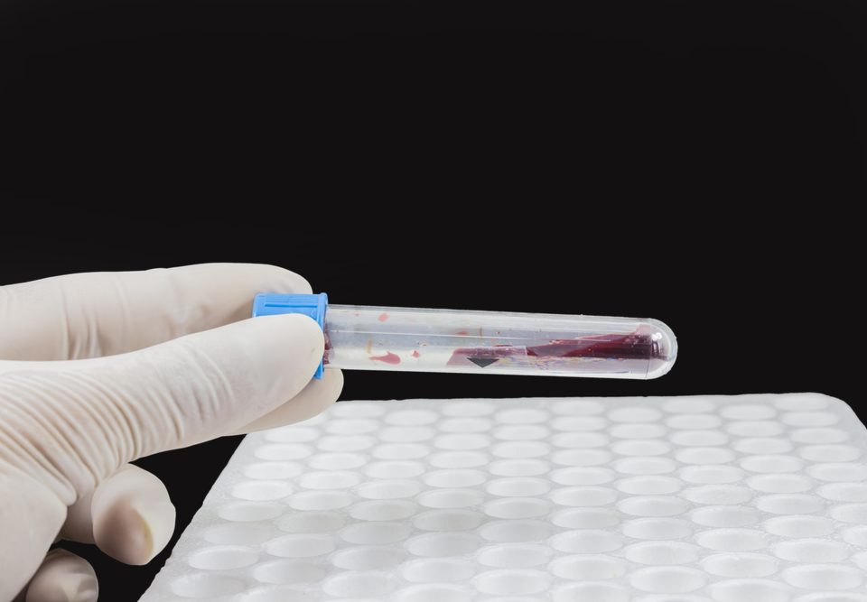 Hyponatraemia