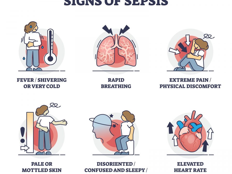 infection and sepsis