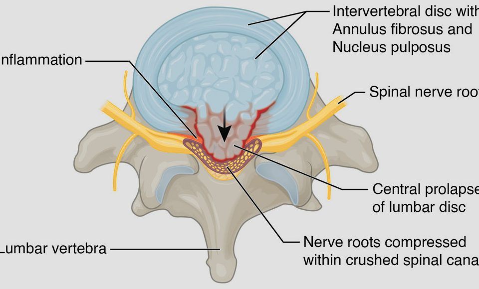 GIRFT pathway and CES