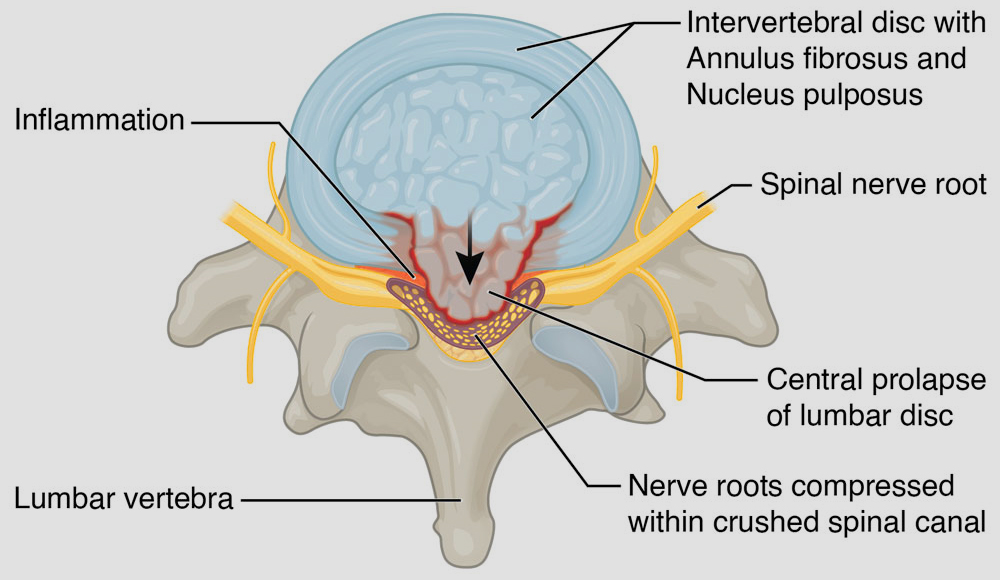 GIRFT pathway and CES
